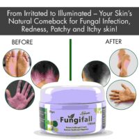 FUNGIFALL CREAM 30GM