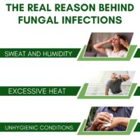 FUNGIFALL CREAM 30GM