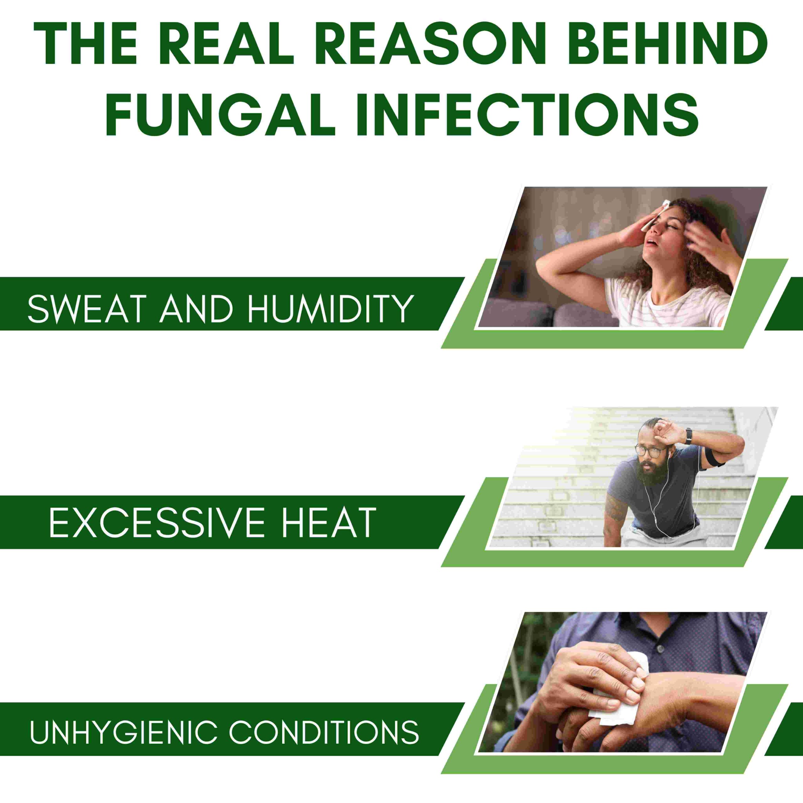 FUNGIFALL CREAM 30GM